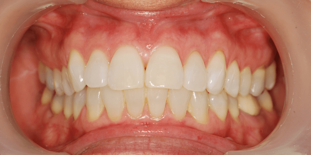 Clinica dental en Puerta de Toledo
