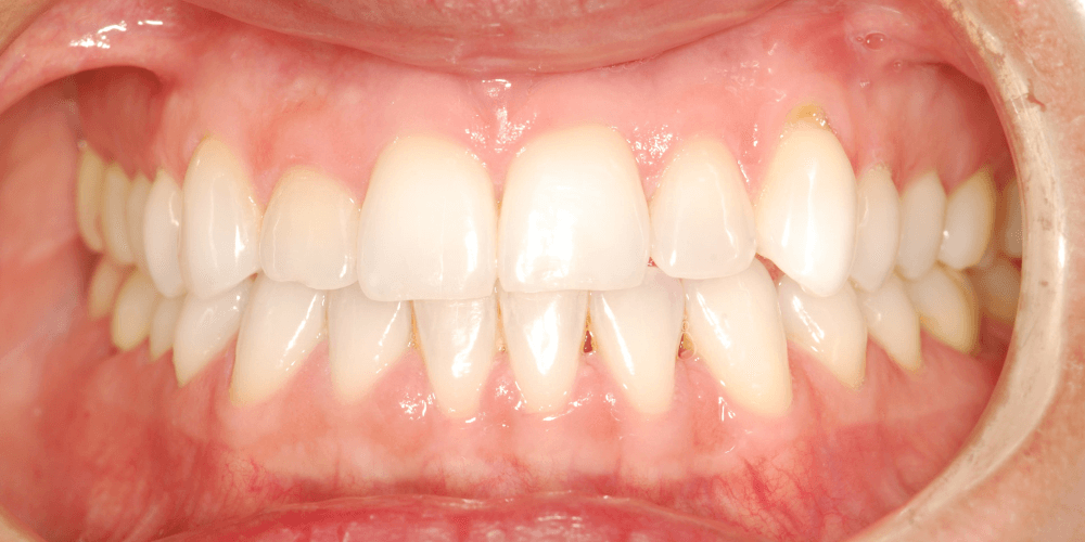 Clinica dental en Puerta de Toledo