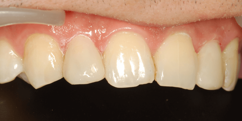 Clinica dental en Puerta de Toledo