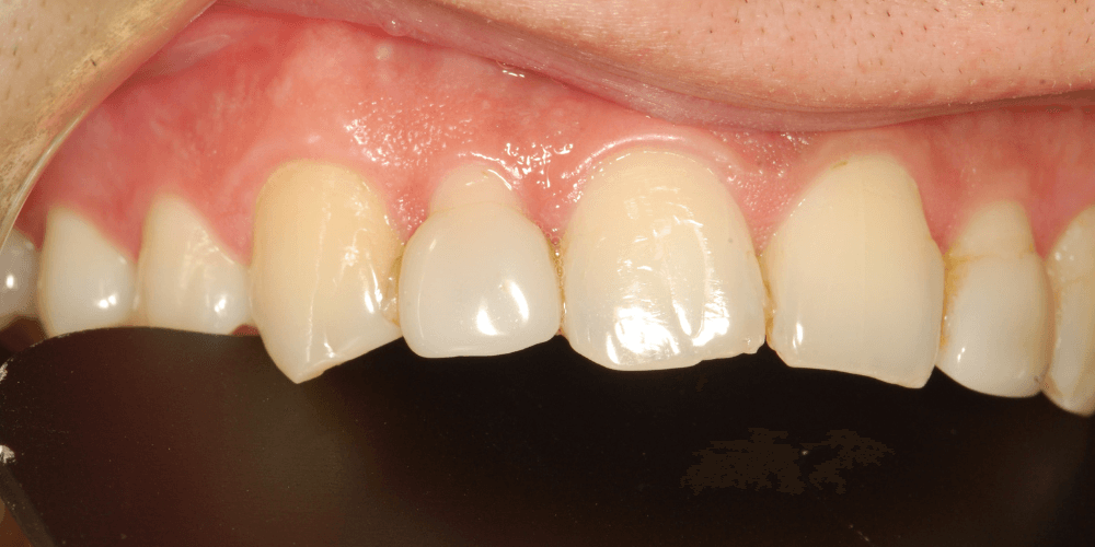 Clínica dental en Puerta de Toledo
