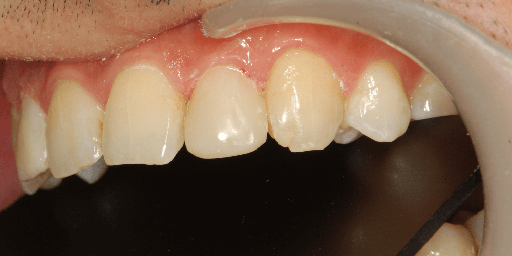 Clinica dental en Puerta de Toledo
