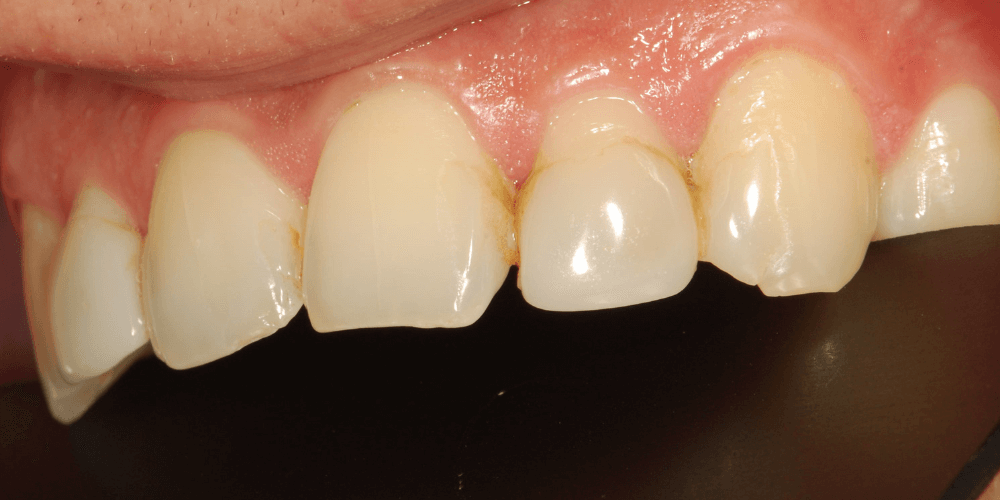 Clínica dental en Puerta de Toledo