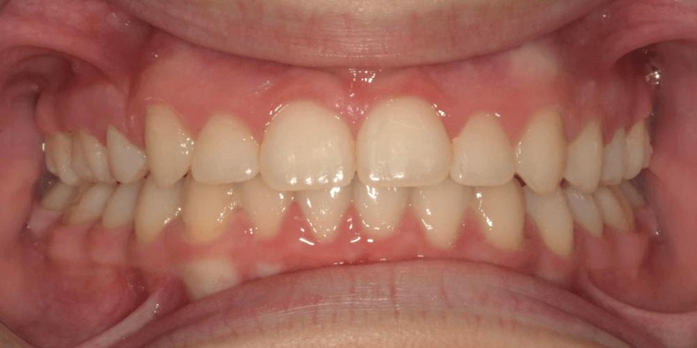 Clinica dental en Puerta de Toledo