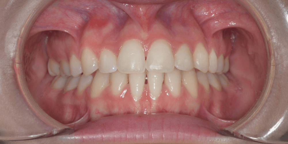 Clinica dental en Puerta de Toledo