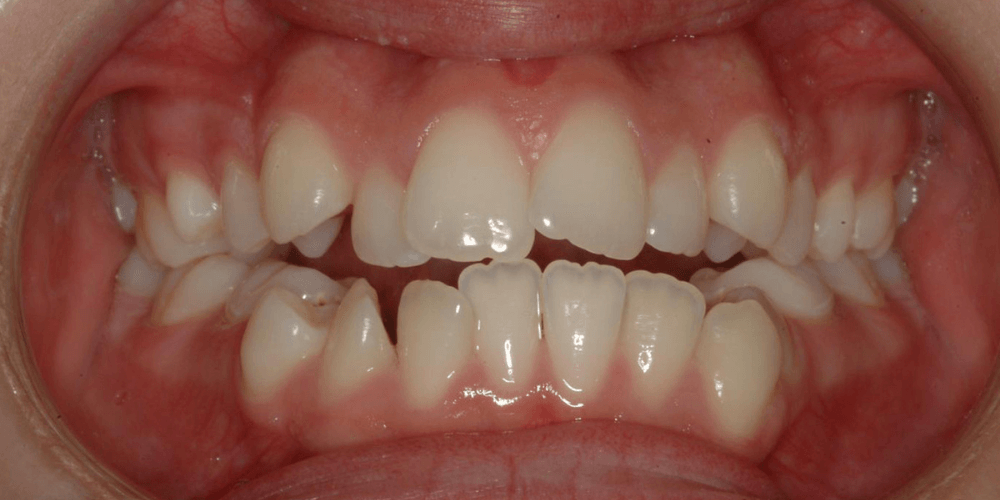 Clínica dental en Puerta de Toledo