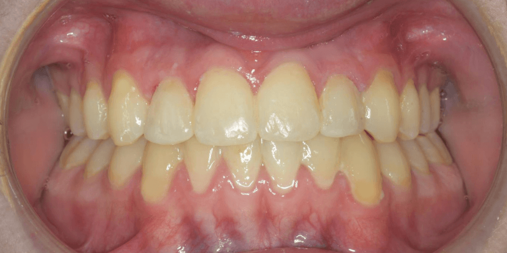 Clinica dental en Puerta de Toledo