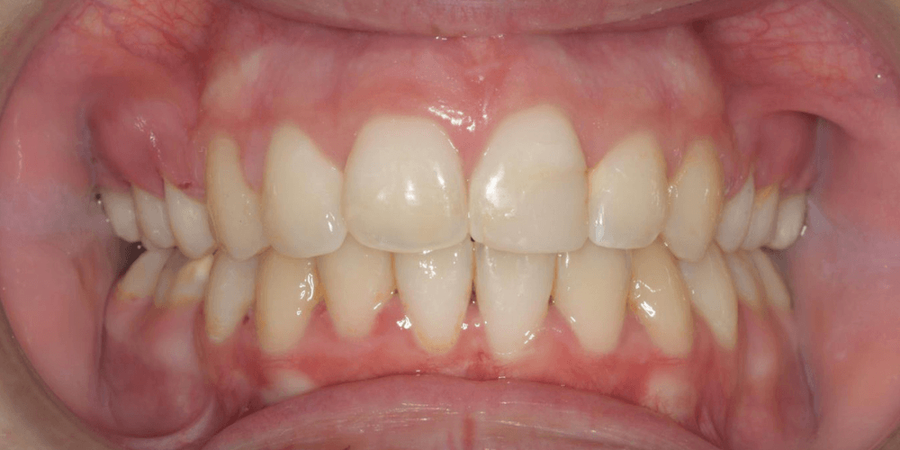 Clinica dental en Puerta de Toledo