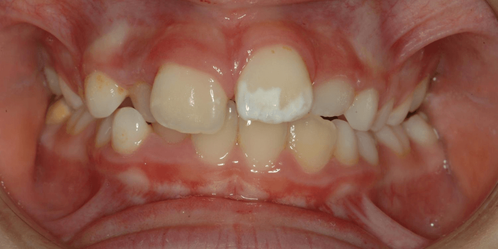 Clínica dental en Puerta de Toledo
