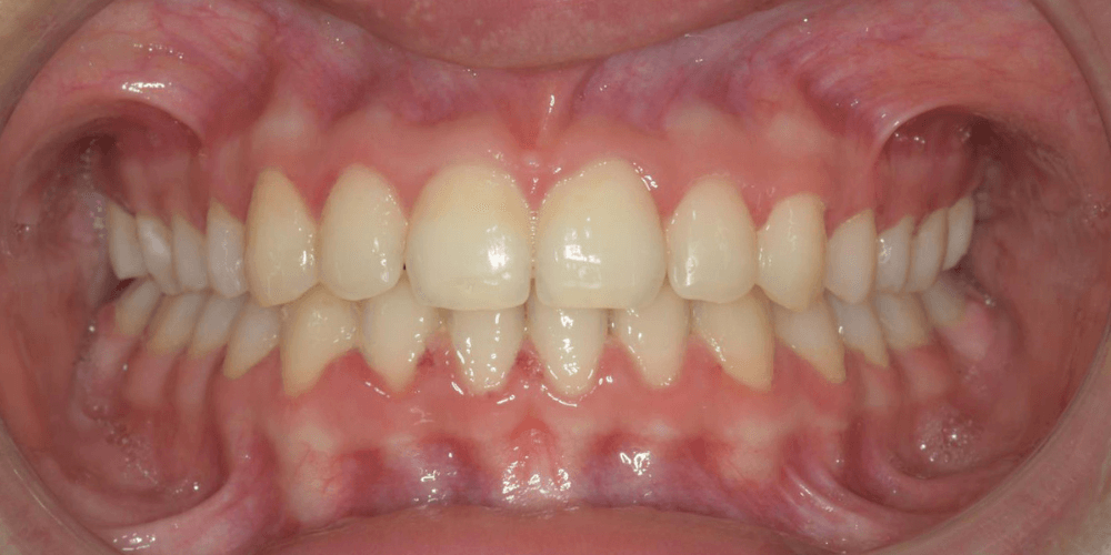 Clinica dental en Puerta de Toledo
