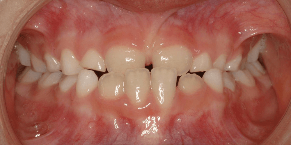 Clínica dental en Puerta de Toledo