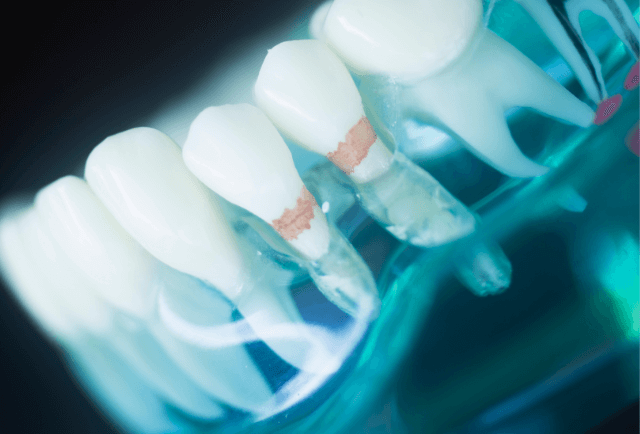 Periodoncia Dental